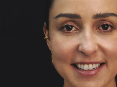 Biosestimulador-de-colageno